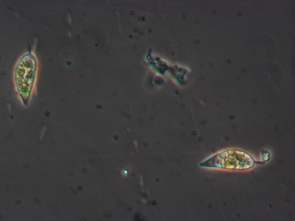 HAB phytoplankton samples